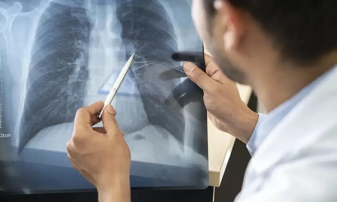 Anvisa aprova remédio inédito para câncer de pulmão avançado e mama