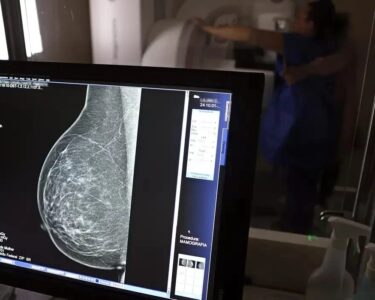 Câncer de mama: mulheres negras morrem 3,8 vezes mais que brancas
