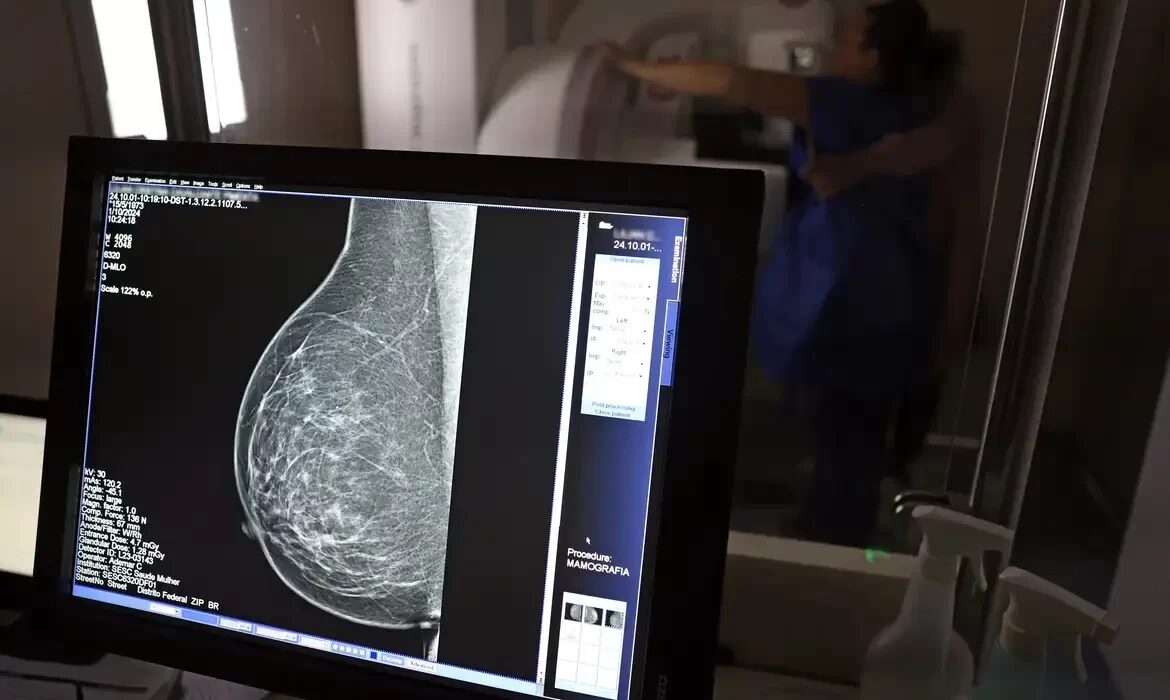 Câncer de mama: mulheres negras morrem 3,8 vezes mais que brancas